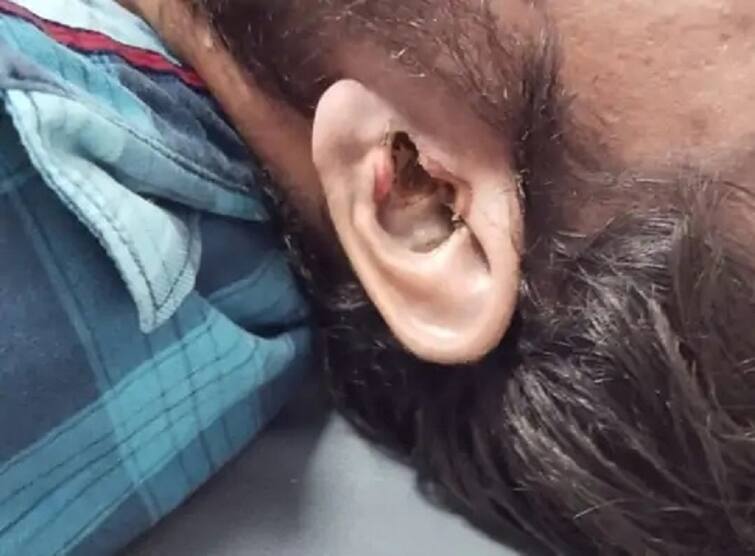 Be careful if you use old gadgets, earphones ruptured while listening to music, young man dies જૂના ગેજેટ્સનો ઉપયોગ કરો છો તો થઈ જાવ સાવધાન, ગીત સાંભળતા કાનમાં ફાટ્યો ઈયરફોન, યુવકનું મોત