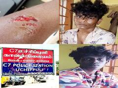 'போலீசை கடித்துக்குதறிய கஞ்சா விற்பனை குற்றவாளிகள்' : ராமநாதபுரத்தில் பரபரப்பு..!