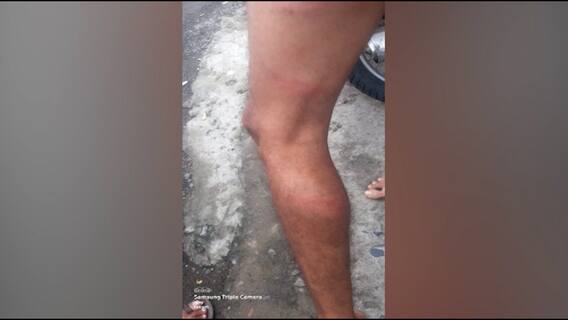 Nagpur : पोलिसांकडून केटरींग व्यवसायिकाला मारहाण केल्याचा आरोप