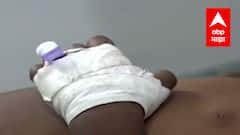 Be Positive : वेळेआधी प्रसुती झालेल्या चिमुकलीला Beed मध्ये जीवदान : ABP Majha