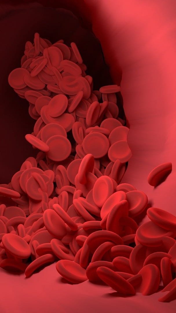 Hemophilia: symptoms and Risk factors main treatment for hemophilia Hemophilia: হিমোফিলিয়া রুখতে অস্ত্র সচেতনতা