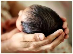 Life Saving Medicine Side Effects: दुर्लभ बीमारी की दवा का साइड इफेक्ट्स, मासूम के पूरे शरीर पर उगे काले बाल