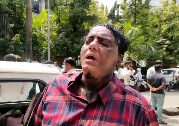 Shiv Sena beats BJP corporator pradeep ramchandani in Ulhasnagar उल्हासनगरात शिवसैनिकांनी भाजप नगरसेवकाला मारहाण करत तोंडाला फासलं काळं, शिवसेनेविरोधात बोलत असल्याने हल्ला