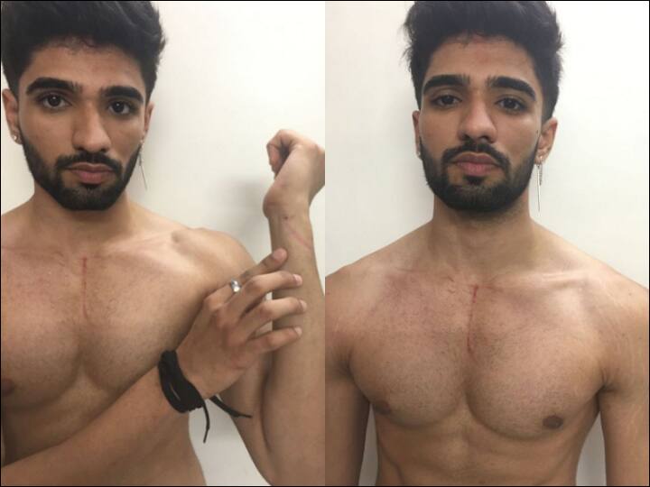 Bigg Boss OTT: Zeeshan Khan Evicted After Fight With Pratik Sehajpal, Shows His Injury Marks, Disappointed Fans Ask Makers To Bring Him Back On Twitter Bigg Boss OTT: Zeeshan Khan Thrown Out Of 'BB' House After Ugly Fight With Pratik Sehajpal, Shows His Injury Marks