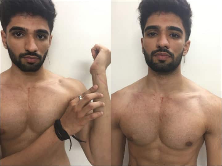 Bigg Boss OTT: Zeeshan Khan Evicted After Fight With Pratik Sehajpal, Shows His Injury Marks, Disappointed Fans Ask Makers To Bring Him Back On Twitter
