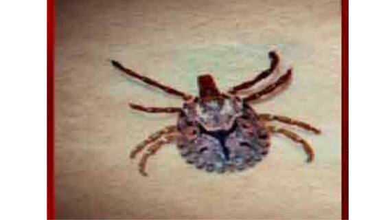 Scrub Typhus: রাজ্যে বাড়ছে স্ক্রাব টাইফাসের সংক্রমণ, সতর্ক হওয়ার পরামর্শ চিকিৎসকদের । Bangla News