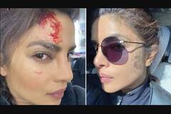 ਸ਼ੂਟਿੰਗ ਦੌਰਾਨ ਜ਼ਖਮੀ ਹੋਈ ਬੌਲੀਵੁੱਡ ਅਦਾਕਾਰਾ ਪ੍ਰਿਯੰਕਾ ਚੋਪੜਾ