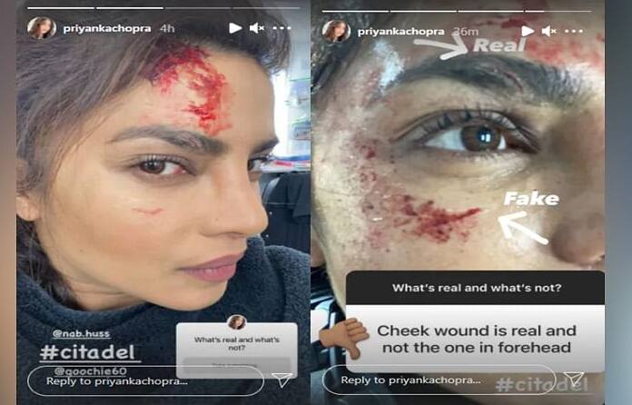 Bollywood Actress Piyanka Chopra Injured In The Shooting Piyanka Chopra Injured: తలకు గాయం.. చిందే రక్తం.. అయినా ఆగని షూటింగ్‌.. ప్రియాంక ఫొటో వైరల్‌
