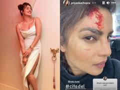 'Citadel' के सेट पर घायल हुईं Priyanka Chopra, खून से लथपथ तस्वीर शेयर कर फैंस से कही ये बात