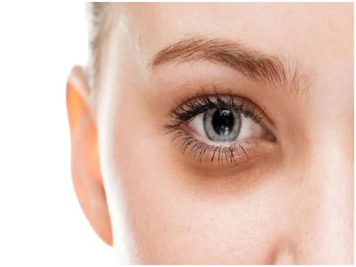 Skincare: आंखों के नीचे पड़ गए हैं डार्क सर्कल्स तो इन उपायों से पाएं छुटकारा