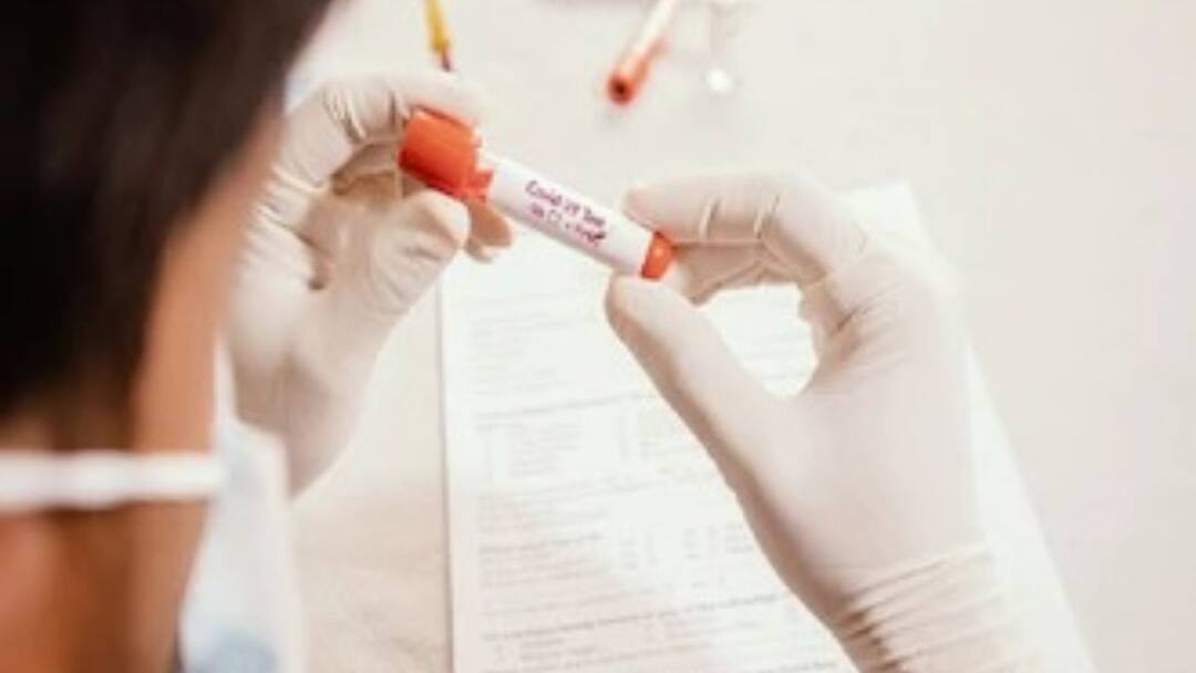 Full Vaccination Halves Long Covid Risk, Reduces Severity Of Breakthrough Infections: UK Study Full Vaccination Halves Long Covid Risk, Reduces Severity Of Breakthrough Infections: UK Study 