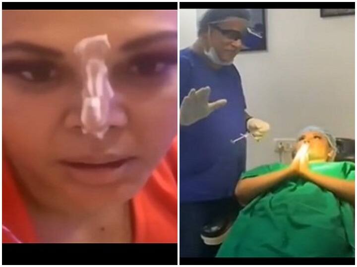 Rakhi Sawant underwent nose surgery after the injury in Bigg Boss Bigg Boss में जैस्मीन भसीन ने तोड़ी थी राखी सावंत की नाक, एक्ट्रेस ने शेयर किया सर्जरी का दर्दनाक Video