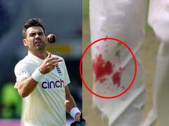 Ind vs Eng 4th Test: роПройрпН роЗроирпНрод ро░родрпНрод ро╡рпЖро▒ро┐... ро░родрпНродроорпН роЪрпКроЯрпНроЯ роЪрпКроЯрпНроЯ рокроирпНродрпБро╡рпАроЪро┐ ро╡ро░рпБроорпН роЖрогрпНроЯро░рпНроЪройрпН! роЕро▓рпНро▓рпЛро▓ роХро▓рпНро▓рпЛро▓родрпНродро┐ро▓рпН роУро╡ро▓рпН!