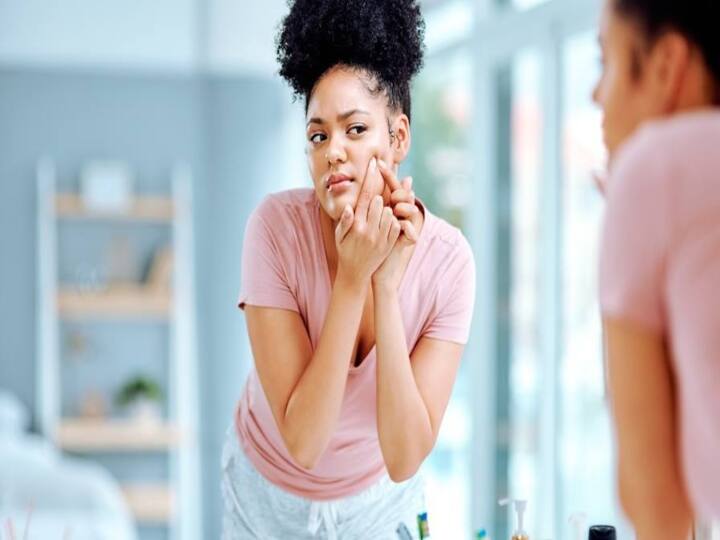 How to get rid of pimples, Check here the Tips, Natural Ways to Remove Pimples Pimples Cure Tips: முகமெல்லாம் பருவா...? இதை செய்தால் பரு உரு தெரியாமல் போகும்!