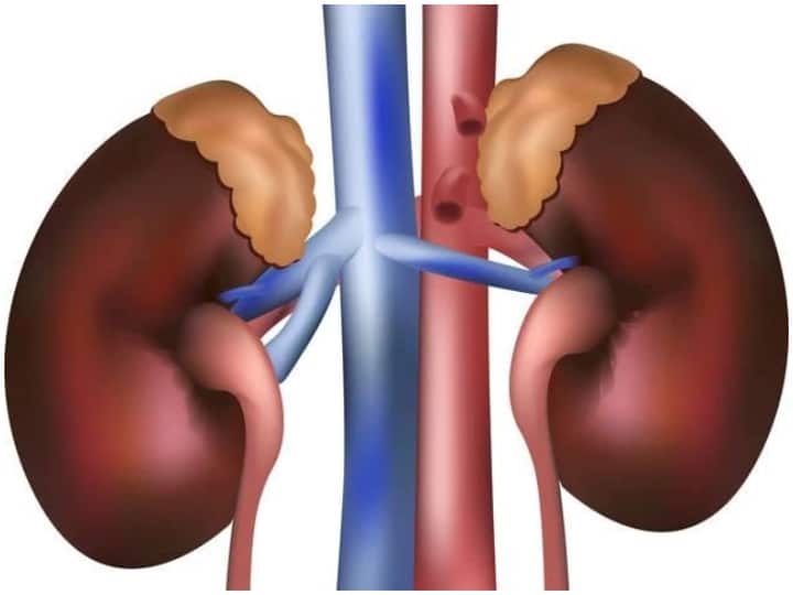 Another hidden Covid risk: lingering kidney problems कोविड-19 का दूसरा छिपा हुआ जोखिम उजागर, किडनी की समस्याएं रहती हैं बरकरार