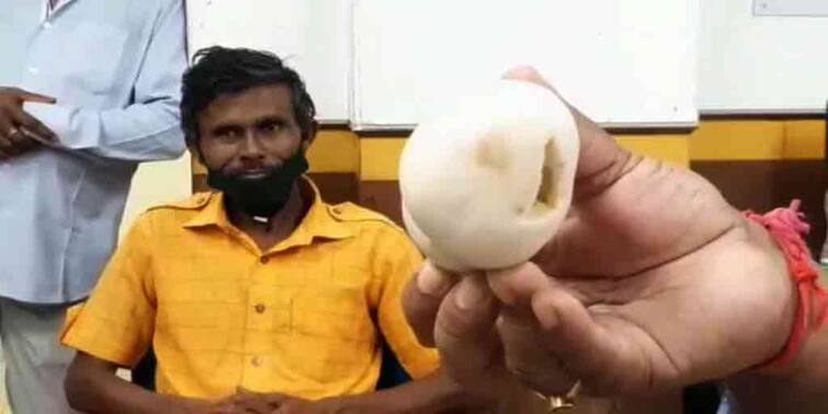 Bankura Sammilani Medical college doctors save life of a daily wager by removing tumour weighing 7.5 kg in rare surgery Bankura: জটিল অস্ত্রোপচারে সাফল্য, শ্রমিকের পেট থেকে বের করা হল ৭.৫ কেজি ওজনের মাংসপিণ্ড