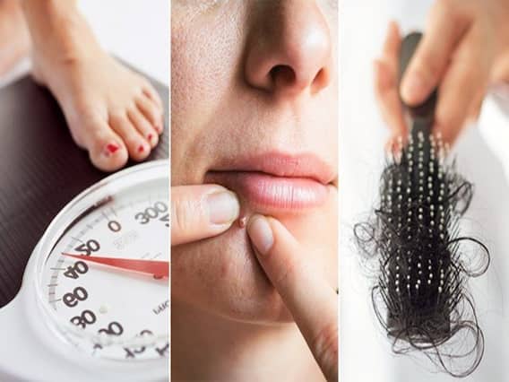 PCOS Is Not A Disease But A Syndrome! Know How Can It Be Detected And Controlled