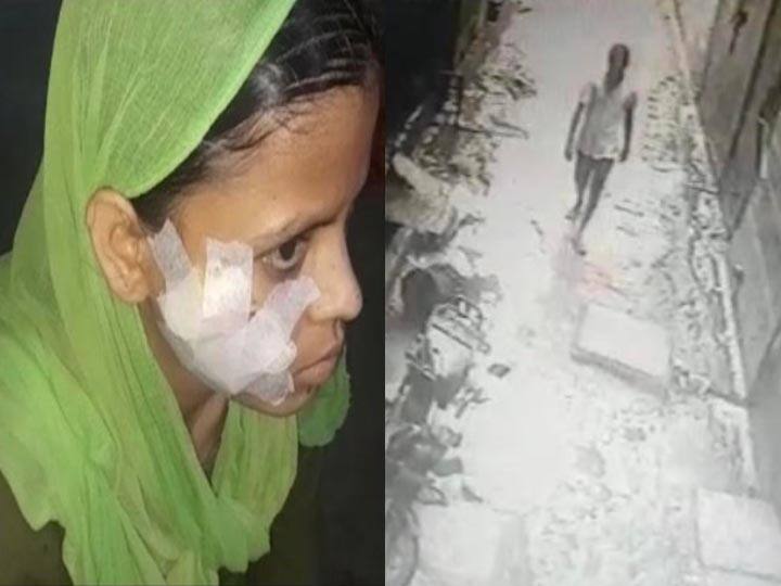 Ghaziabad Crime: सिरफिरे ने एक और महिला के मुंह पर मारा चाकू, 24 घंटे में दूसरी वारदात से दहशत