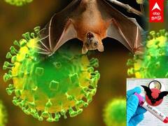 Nipah Virus Update: நிபா வைரஸ் எப்படி பரவும்?நீங்கள் முக்கியமாக அறிந்துகொள்ள வேண்டியவை இதோ!