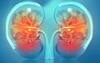 Signs of kidney disease: ఈ లక్షణాలు కనిపిస్తే తేలికగా తీసుకోకండి... వైద్యుడిని కలవండి