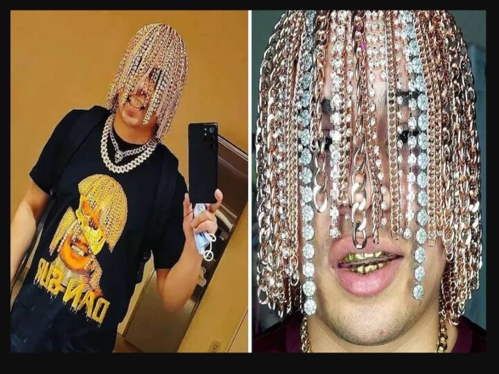 Mexican Rapper Dan Sur's photo with Gold chains imparted into his scalp goes viral in instagram முடி எங்கடா...  அது ஓல்டு மாடல்... அதுக்கு பதிலா செயின் நட்டாச்சு! - ராப் பாடகரின் வைரல் சம்பவம்!