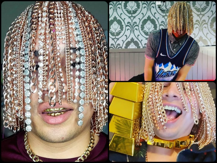 Mexican Rapper Dan Sur ने कराई अनोखी Scalp सर्जरी, अब सिर से बालों की जगह लटकते हैं सोने-हीरे, देखने वालों के होश उड़े