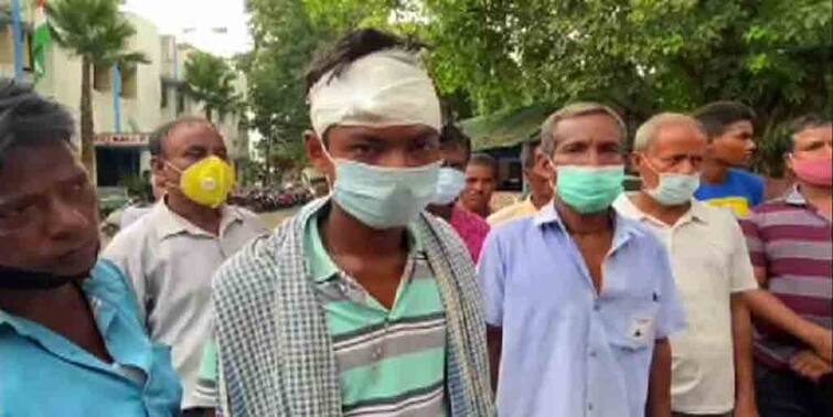 Trinamool-BJP clash over land, several villagers including several women injured in Jalpaiguri Jalpaiguri: জমি নিয়ে তৃণমূল - বিজেপি সংঘাত, জলপাইগুড়িতে জখম মহিলা সহ একাধিক গ্রামবাসী