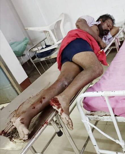 திருச்சியில் மது போதையில் பேருந்தை மறித்து ரகளை - தடுக்க சென்ற எஸ்.ஐக்கு கத்திக்குத்து...!