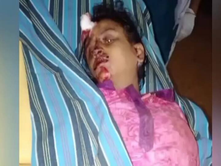 The husband escaped after cutting off his wife who was in private custody in Theni தேனி: தனியார் காப்பகத்தில் இருந்த மனைவியை சரமாரியாக வெட்டிவிட்டு கணவன் தப்பியோட்டம்