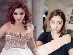 एक्ट्रेस Payal Ghosh ने किया बड़ा दावा, कहा- अज्ञात हमलावरों ने एसिड डालने की कोशिश की, दिखाए चोट के निशान