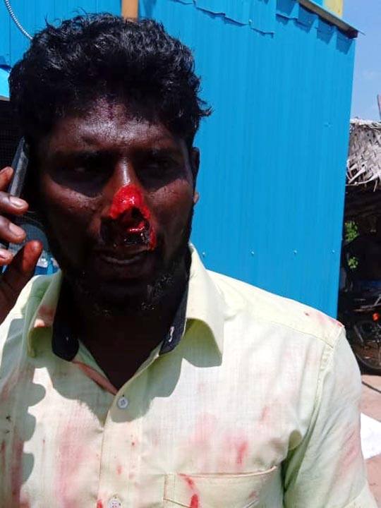 Thieves cut off the nose of a youth in Thanjavur and chased him away இளைஞரின் மூக்கை வாளால் வெட்டி வழிப்பறி - தப்பியோடிய கொள்ளையர்கள் துரத்திப்பிடித்த போலீஸ்