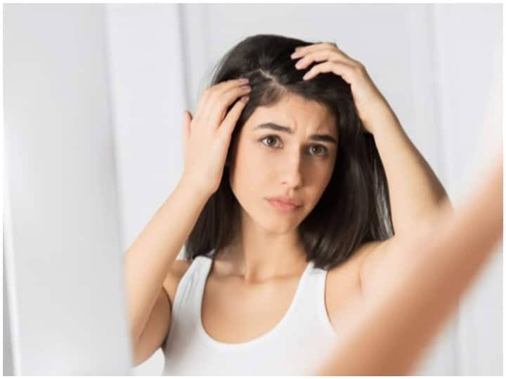 Hair Care Tips: Want To Get Rid Of Dandruff? Try These Natural Remedies Hair Care Tips: Want To Get Rid Of Dandruff? Try These Natural Remedies