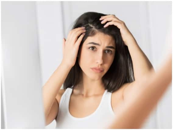 Health Care Tips: Dandruff की समस्या से पाना है छुटकारा? तो इन नेचुरल चीजों का करें इस्तेमाल Health Care Tips: Dandruff की समस्या से पाना है छुटकारा? तो इन नेचुरल चीजों का करें इस्तेमाल