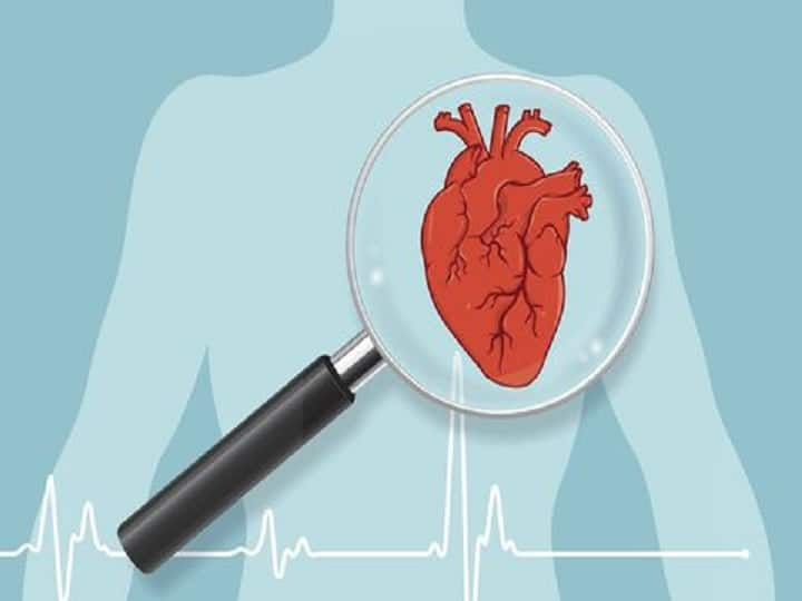 Cardiac Arrest Vs Heart Attack: What is the Difference? மாரடைப்பு- ஹார்ட் அட்டாக்: இரண்டும் வேறுதான்..வித்தியாசம் அறிவது எப்படி?