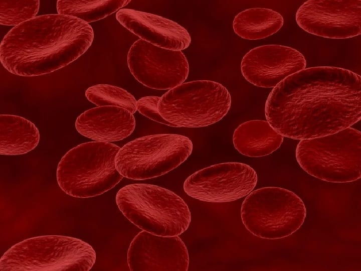 Know about the Hemoglobin Deficiency Reasons, symptoms and cure Low Hemoglobin: कहीं आप भी तो नहीं जूझ रहे हैं हीमोग्लोबिन की कमी से? जानिए इसके लक्षण और कारण