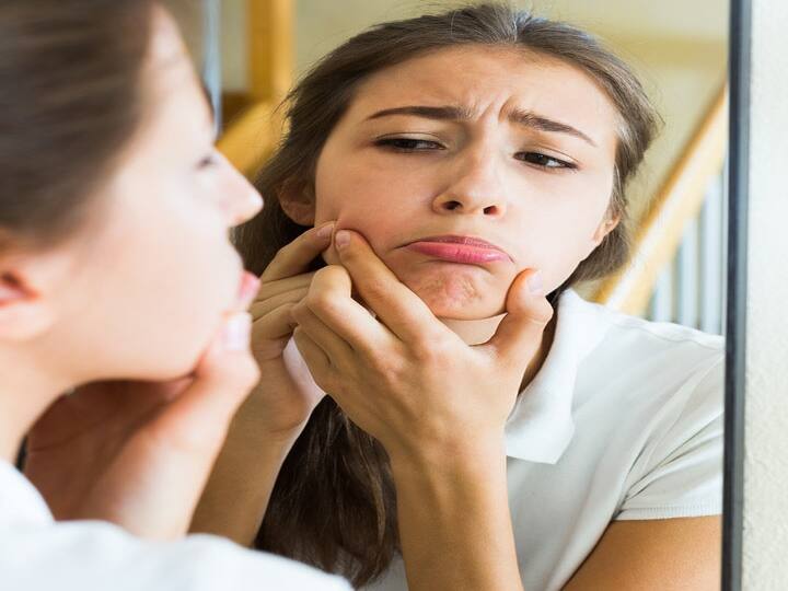 This mistake you made in the morning becomes the cause of acne, change the habit for skin clarity Beauty Tips: સવારે કરેલી આપની આ ભૂલ બને છે ખીલનું કારણ, સ્કિનના નિખાર માટે બદલો આદત