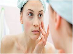 Skin Care Tips: Dark Circles क्यों होते हैं? इन घरेलू तरीकों को अपनाकर इस समस्या से पाएं छुटकारा