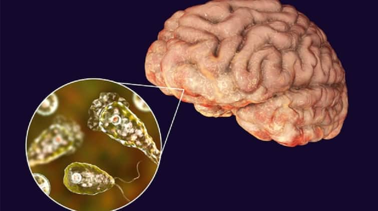 Boy dies from brain-eating amoeba in texas, gets into skull while playing at water park બાળકનું મગજ ખાઈ ગયા જંતુઓ, મૃત્યુ બાદ ખબર પડી પાર્કમાં રમતા સમયે થઈ હતી આ મોટી ભૂલ