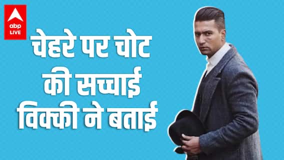 Sardar Udham में Vicky Kaushal के चेहरे पर चोट के निशान हैं असली, विक्की ने बताई सच्चाई