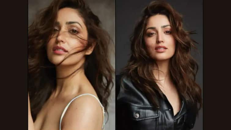 Yami Gautam Opens Up About Her Skin Condition Keratosis-Pilaris, know in details Yami Gautam Update: মারাত্মক ত্বকের সমস্যায় ভুগছেন ইয়ামি গৌতম, জানালেন কী হয়েছে তাঁর