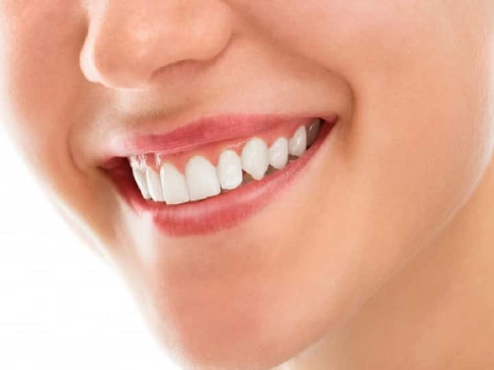 Teeth Whitening tips Teeth Whitening:  દાંતને સફેદ બનાવવાનો આ છે સરળ અચૂક નુસખો,  અજમાવી જુઓ