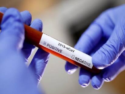 corona: 1449 persons tested positive today , 16 fatality cases கொரொனா: தமிழகத்தில் 1449 பேருக்கு கொரோனா...16 பேர் உயிரிழப்பு