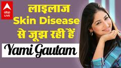 कौन सी लाइलाज Skin Disease से जूझ रही हैं Yami Gautam ?