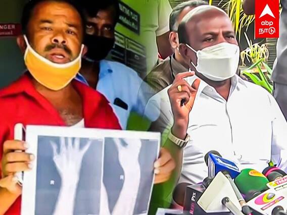 Ma Subramanian speech: பேப்பரில் எக்ஸ்ரே ப்ரிண்ட்.. நிதிச்சுமைதான் காரணமா? விளக்கமளித்த மா.சு