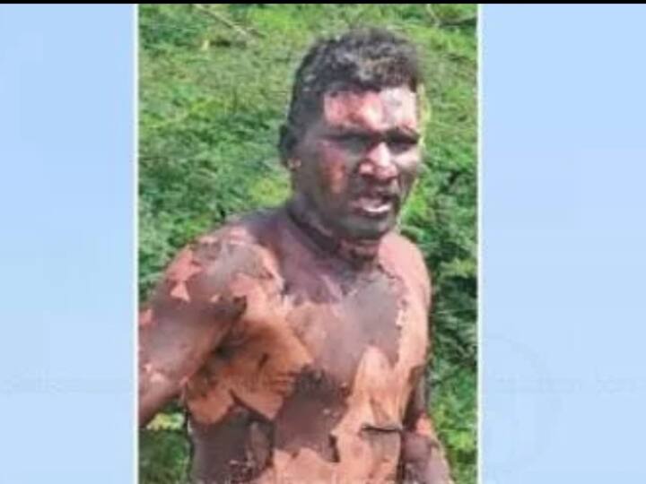 Young got steamed in fire And killed by 6 members near minjur ஏரிக்கரைக்கு இளம் பெண்ணுடன் சென்றவர்... பெட்ரோல் ஊற்றி எரிப்பு! நடந்தது என்ன?