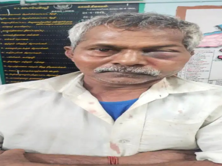 முந்திரி தொழிற்சாலை கொலை: நீதிமன்றத்தில் சரணடைந்தார் கடலூர் திமுக எம்பி ரமேஷ்!