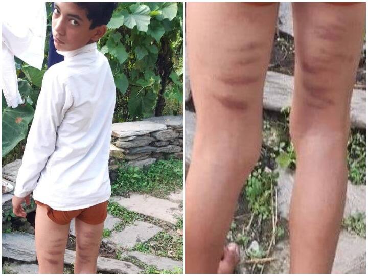 नैनीताल: सरकारी स्कूल के शिक्षकों पर कक्षा 8वीं के छात्र को डंडे से पीटने का आरोप, पिता ने की कार्रवाई की मांग Nainital Government school teachers accused of beating class 8 student with a stick father demands action ANN नैनीताल: सरकारी स्कूल के शिक्षकों पर कक्षा 8वीं के छात्र को डंडे से पीटने का आरोप, पिता ने की कार्रवाई की मांग