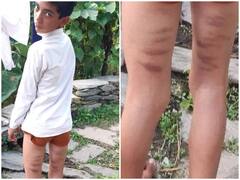 नैनीताल: सरकारी स्कूल के शिक्षकों पर कक्षा 8वीं के छात्र को डंडे से पीटने का आरोप, पिता ने की कार्रवाई की मांग