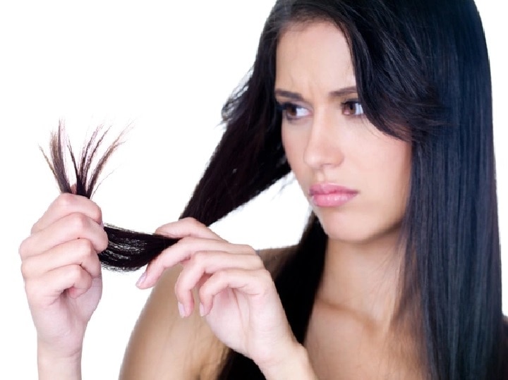These Four Disease Can Cause Severe Hair Fall Problem | Hair Fall: इन 4  बीमारियों के कारण तेजी झड़ सकते हैं बाल, इस तरह पहचाने लक्षण