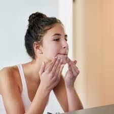 Skin Care Tips: ਅੱਜਕੱਲ੍ਹ ਲੋਕਾਂ ਵਿੱਚ ਮੁਹਾਸੇ ਦੀ ਸਮੱਸਿਆ ਆਮ ਹੁੰਦੀ ਜਾ ਰਹੀ ਹੈ। ਲੜਕੇ ਹੋਣ ਜਾਂ ਲੜਕੀਆਂ, ਸਾਰੇ ਇਸ ਸਮੱਸਿਆ ਤੋਂ ਪ੍ਰੇਸ਼ਾਨ ਹਨ। ਮੁਹਾਸੇ ਸਾਡੇ ਚਿਹਰੇ ਦੀ ਖੂਬਸੂਰਤੀ ਨੂੰ ਖਰਾਬ ਕਰਦੇ ਹਨ।